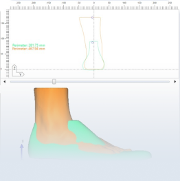 DESENHO

Com todos os dados dos seus pés captados na avaliação, a equipe de desenho utiliza um software para desenhar os seus calçados com as medidas e ajustes necessários para os seus pés.